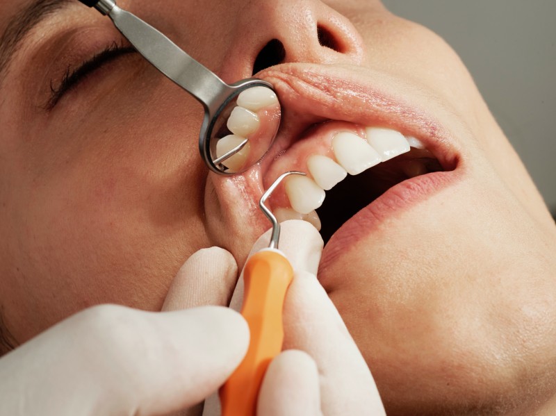 DASRI des cabinets dentaires de Narbonne, une solution d’élimination simple et sur-mesure