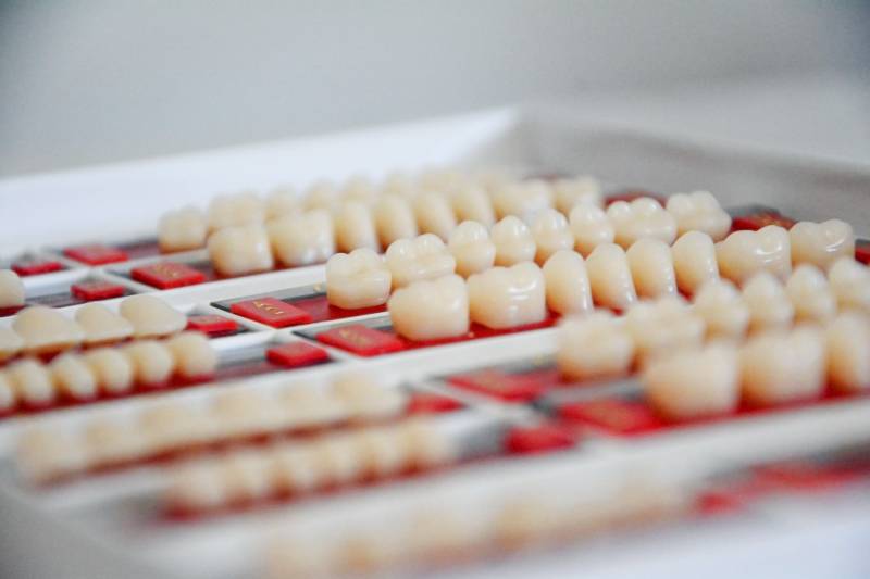 Collecte des amalgames dentaires des cabinets dentaires dans l’Hérault