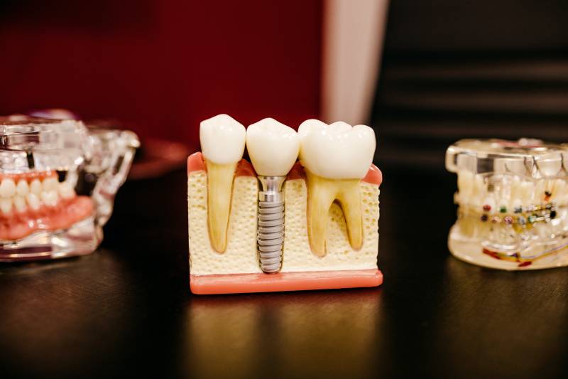Collecte des DASRI et Amalgames dentaires des cabinets dentaires