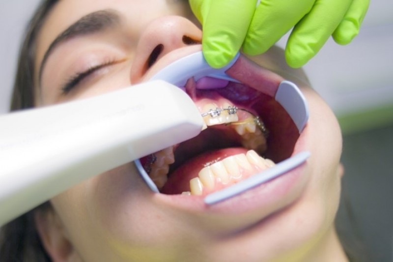 Déchets dangereux des cabinets dentaires de l'Hérault 34