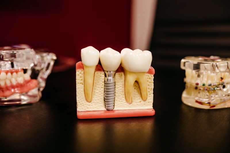 DASRI des cabinets dentaires de Narbonne, une solution d’élimination simple et sur-mesure
